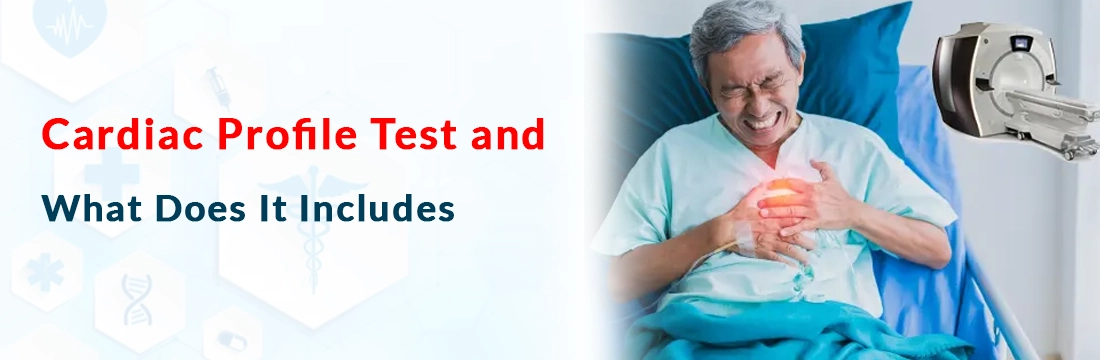 Cardiac Profile Test and What Does It Includes